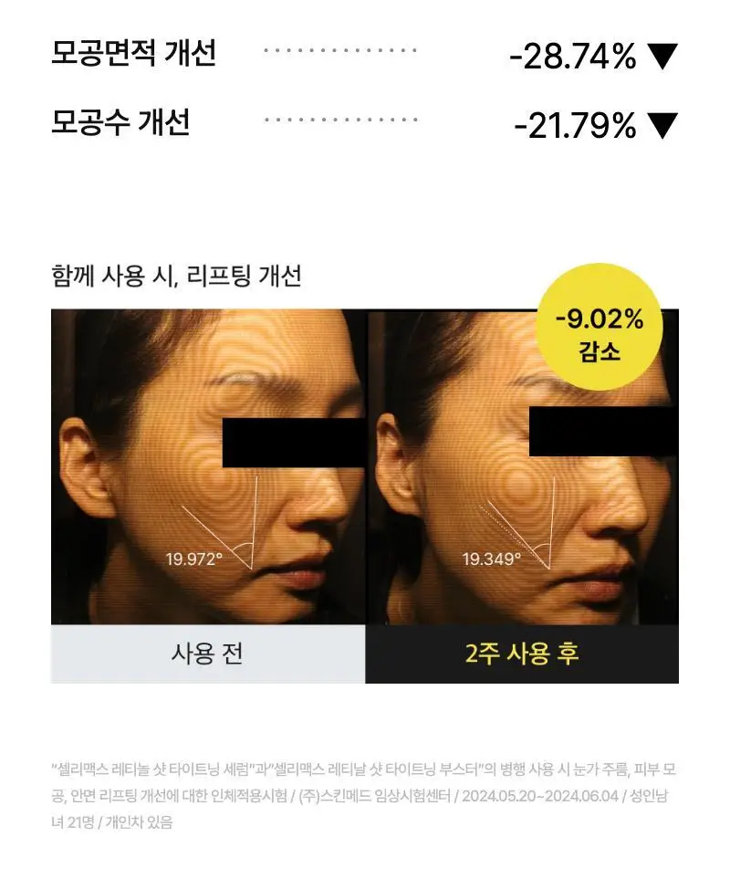 [모공/탄력/결] 셀리맥스 더 비타 A 레티놀 샷 타이트닝 세럼 30ml 상세페이지 43
